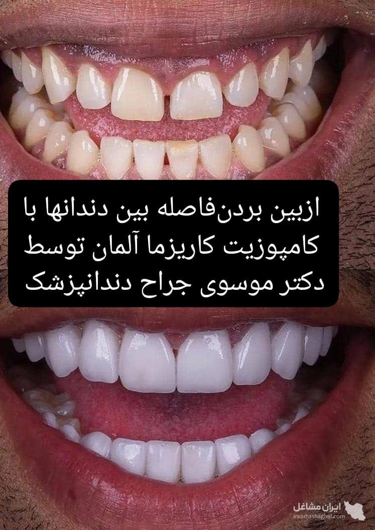 مطب تخصصی ایمپلنت و کامپوزیت دندان دکتر موسوی در تهرانپارس تهران